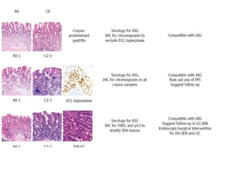 Case study on autoimmune gastristis...gokia