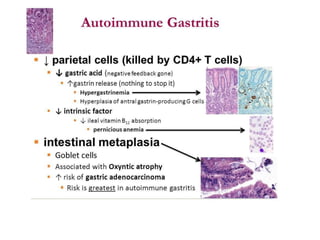 Case study on autoimmune gastristis...gokia