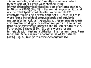 •linear, nodular, and exceptionally alsoadenomatoid
hyperplasia of ECL cells wasdetected using
immunohistochemical visualiza-tion of chromogranin-A
in 20 cases (80%) (Fig. 3).In the remaining cases, it could
not be reliablydifferentiated between simple ECL
cellshyperplasia and normal count of ECL cells. ECLcells
were found in residual corpus glands and inpyloric
metaplasia. In nodular hyperplasia, theseelements were
scattered in small groups in thedeep parts of the lamina
propria, sometimesadjacent to the muscularis mucosae.
Further, in13 cases (52%) ECL cells were present
inmetaplastic intestinal epithelium in smallnumbers. Rare
individual G cells were dispersedin IM of 11 patients
(44%) (Fig. 4), but were neverseen outside IM
 