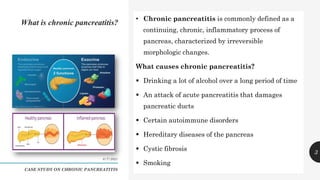 Case study on chronic pancreatitis | PDF