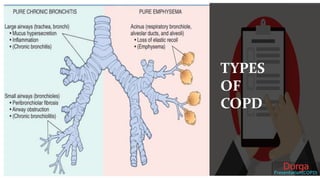 CASE PRESENTATION ON CHRONIC OBSTRUCTIVEPULMONARY DISEASE | PPTX