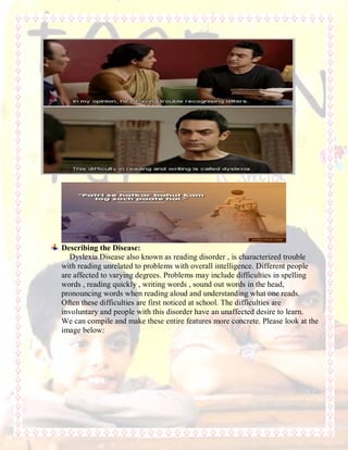 Describing the Disease:
Dyslexia Disease also known as reading disorder , is characterized trouble
with reading unrelated to problems with overall intelligence. Different people
are affected to varying degrees. Problems may include difficulties in spelling
words , reading quickly , writing words , sound out words in the head,
pronouncing words when reading aloud and understanding what one reads.
Often these difficulties are first noticed at school. The difficulties are
involuntary and people with this disorder have an unaffected desire to learn.
We can compile and make these entire features more concrete. Please look at the
image below:
 