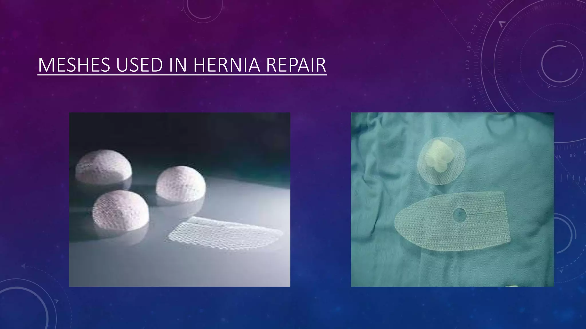 MESHES USED IN HERNIA REPAIR

 