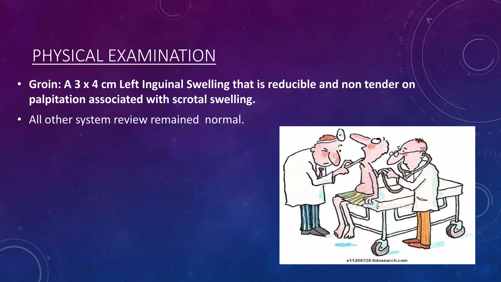 PHYSICAL EXAMINATION
• Groin: A 3 x 4 cm Left Inguinal Swelling that is reducible and non tender on
palpitation associated with scrotal swelling.
• All other system review remained normal.

 