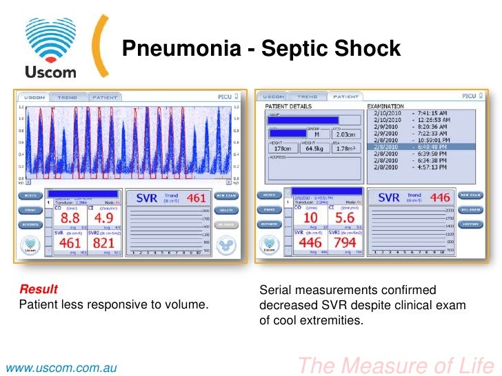 Pediatric pneumonia case study pdf image