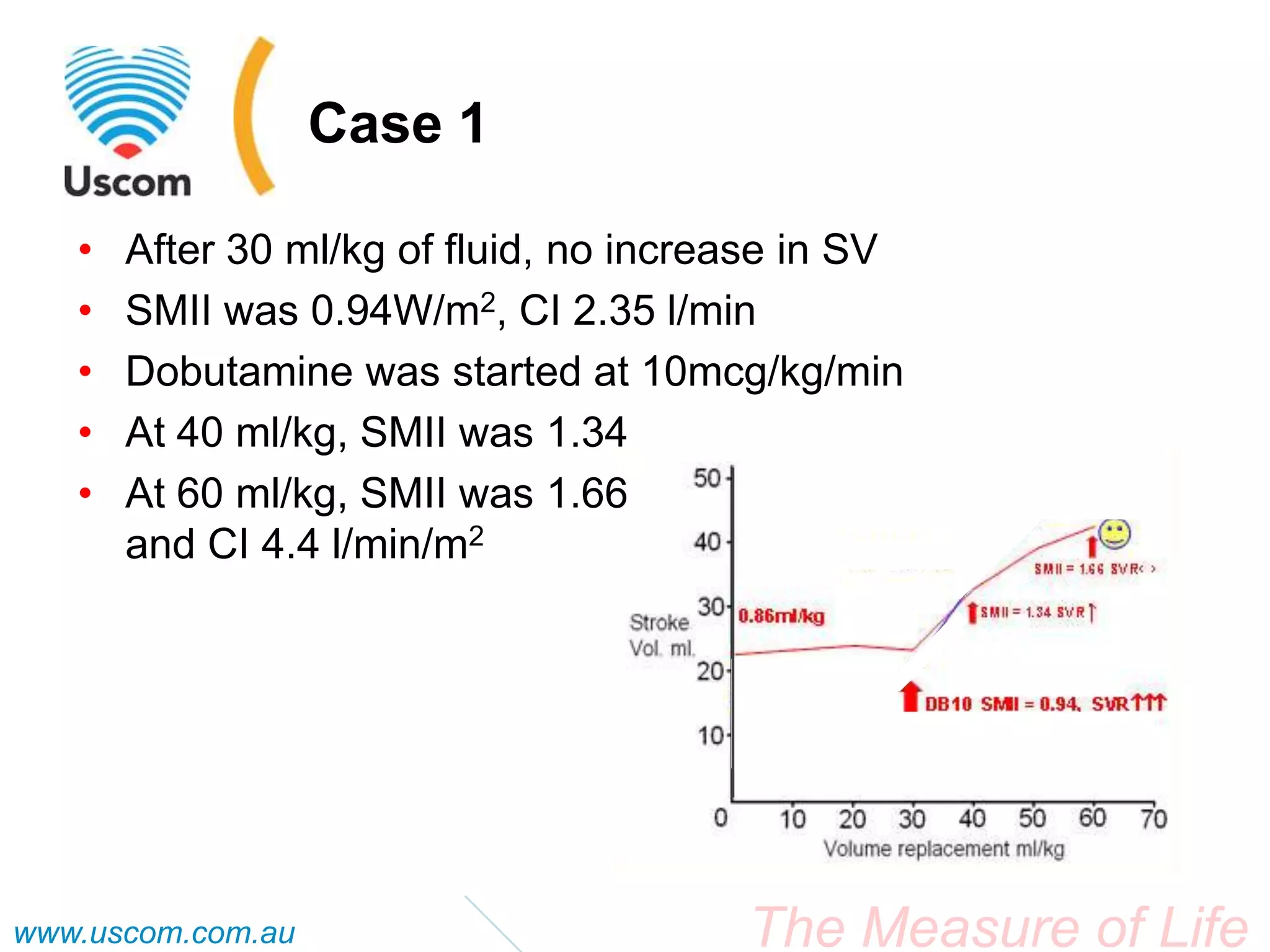 Smii Interface Case Study - Pediatric - Septic Shock - Fluid Responsiveness and SMII ...