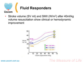 The Measure of Lifewww.uscom.com.au
Fluid Responders
• Stroke volume (SV ml) and SMII (W/m2) after 40ml/kg
volume resuscitation show clinical or hemodynamic
improvement
 
