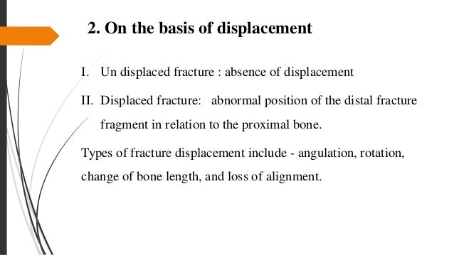Shaft Of Femur Fracture