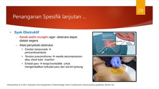 • Syok Obstruktif
– Kenali sedini mungkin agar obstruksi dapat
diatasi segera
– Atasi penyebab obstruksi:
• Cardiac tamponade 
pericardiosentesis
• Tension pneumothorax  needle decompression
atau chest tube insertion
• Emboli paru  terapi trombolitik untuk
mengembalikan sirkulasi paru dan sisi kiri jantung
Penanganan Spesifik lanjutan ...
29
Vishwanathan et al 2021, Evaluation and management of haemorrhagic shock in polytrauma: Clinical practice guidelines, Elsevier Ltd
 