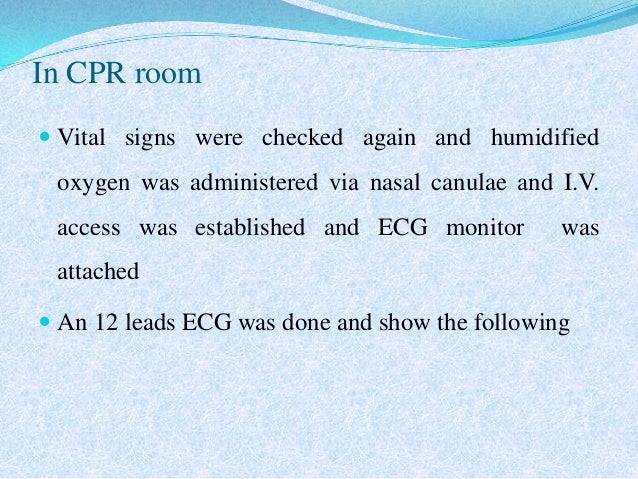 Supraventricular tachycardia image