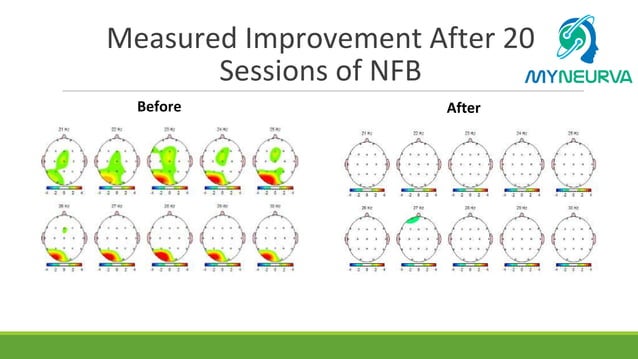 Case study tbi (1) | PPT
