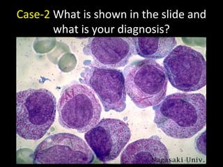 Case-2 What is shown in the slide and
what is your diagnosis?
 