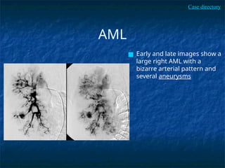 cases_vascular.pptx Radiology Reporting Sample | PPTX