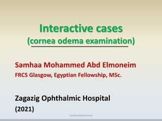 Interactive cases
(cornea odema examination)
Samhaa Mohammed Abd Elmoneim
FRCS Glasgow, Egyptian Fellowship, MSc.
Zagazig Ophthalmic Hospital
(2021)
Samhaa Mohammed
 