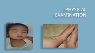 PHYSICAL
EXAMINATION
 