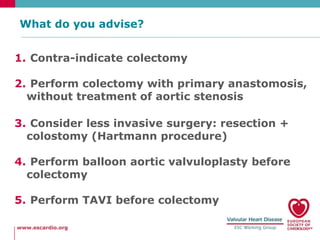 Aortic stenosis and indication for non-cardiac surgery | PPTX
