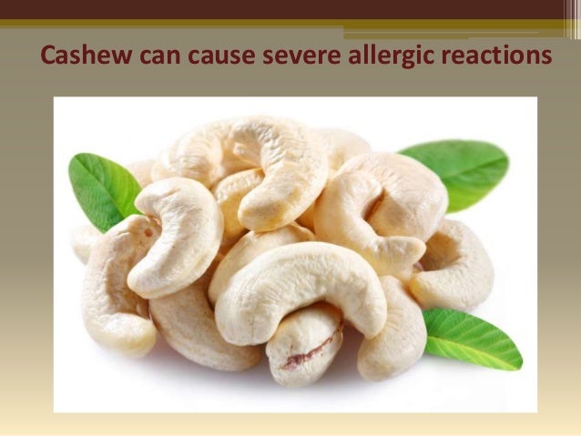 cashew allergy skin rash babies cashew allergy skin rash babies