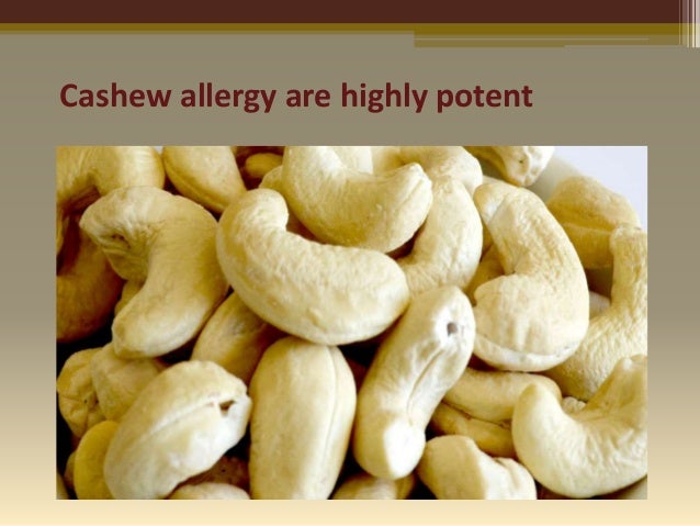 cashew allergy foods to avoid