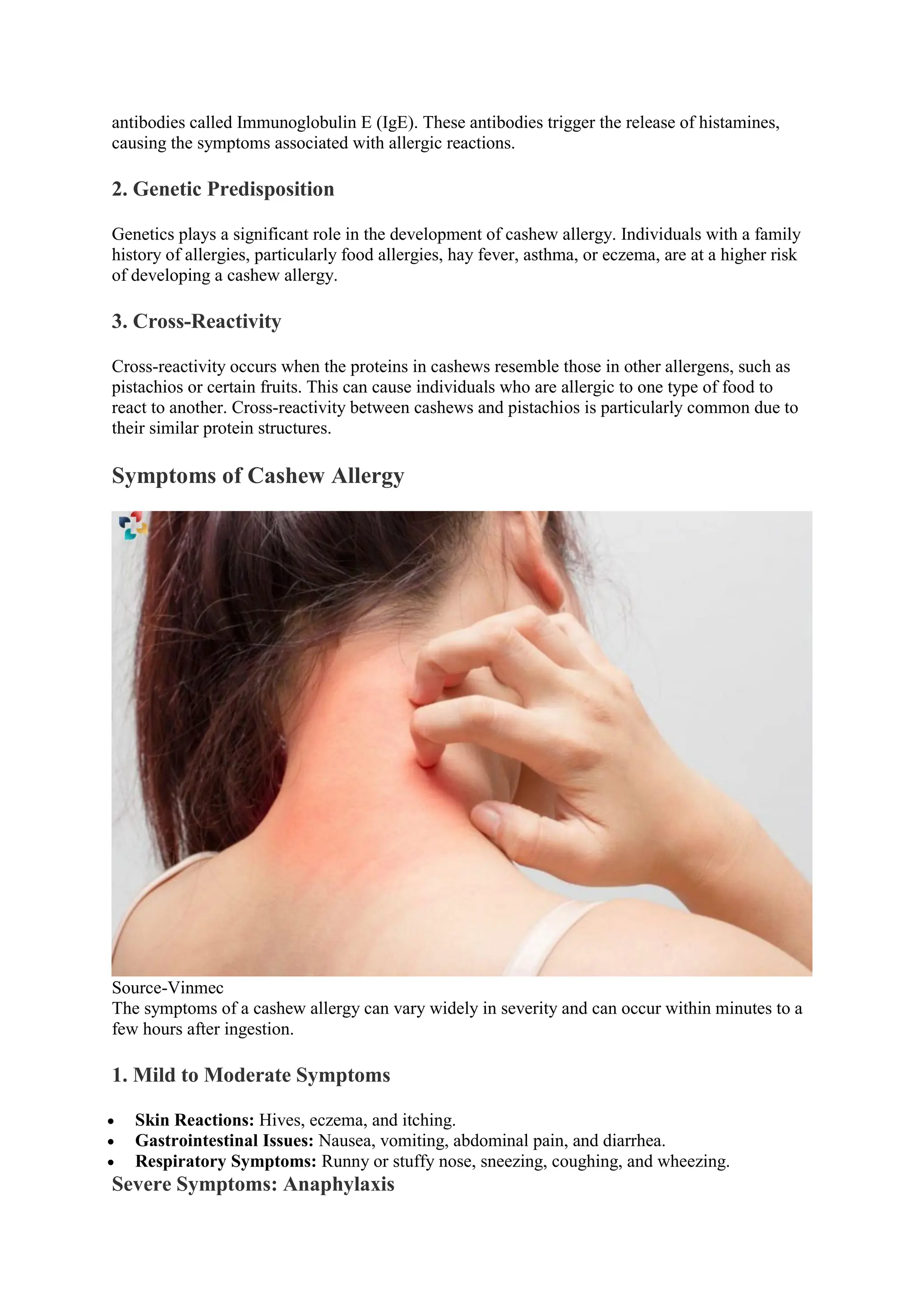 Nut Rash Cashew Allergy: Causes, Symptoms, Preventions, and Diagnosing | The ...