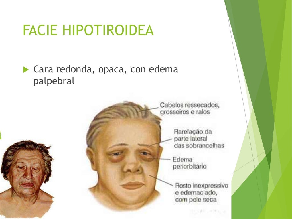 Semiologia Médica - Facies