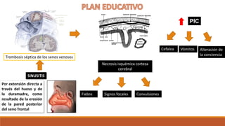 Trombosis séptica de los senos venosos
Por extensión directa a
través del hueso y de
la duramadre, como
resultado de la erosión
de la pared posterior
del seno frontal
SINUSITIS
Necrosis isquémica corteza
cerebral
ConvulsionesSignos focales
Cefalea
PIC
Vómitos Alteración de
la conciencia
Fiebre
 
