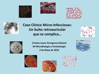 Caso Clínico Micro-Infecciosas:
Un bulto retroauricular
que se complica…
Cristina Juana Torregrosa Hetland
R4 Microbiología y Parasitología
4 de Mayo de 2018
 