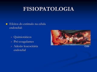 FISIOPATOLOGIA
 Efeitos do estímulo na célula
endotelial:
 Quimiotáticos
 Pró-coagulantes
 Adesão leucocitária
endotelial
CID
 