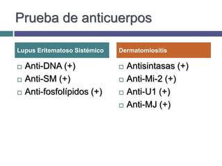 Prueba de anticuerpos
 Anti-DNA (+)
 Anti-SM (+)
 Anti-fosfolípidos (+)
 Antisintasas (+)
 Anti-Mi-2 (+)
 Anti-U1 (+)
 Anti-MJ (+)
Lupus Eritematoso Sistémico Dermatomiositis
 