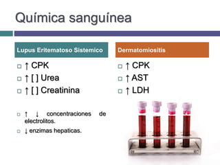 Química sanguínea
 ↑ CPK
 ↑ [ ] Urea
 ↑ [ ] Creatinina
 ↑ ↓ concentraciones de
electrolitos.
 ↓ enzimas hepaticas.
 ↑ CPK
 ↑ AST
 ↑ LDH
Lupus Eritematoso Sistemico Dermatomiositis
 