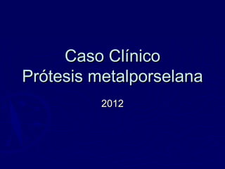 Caso ClínicoCaso Clínico
Prótesis metalporselanaPrótesis metalporselana
20122012
 