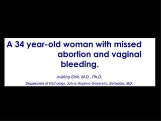 A 34 year-old woman with missed  abortion and vaginal bleeding. Ie-Ming Shih, M.D., Ph.D.   Department of Pathology, Johns Hopkins University. Baltimore, MD.   