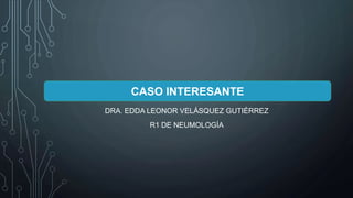 DRA. EDDA LEONOR VELÁSQUEZ GUTIÉRREZ
R1 DE NEUMOLOGÍA
CASO INTERESANTE
 