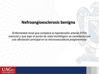 Nefroangioesclerosis benigna
Enfermedad renal que complica la hipertensión arterial (HTA)
esencial y que bajo el punto de vista morfológico se caracteriza por
una afectación principal en la microvasculatura preglomerular.
 