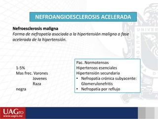 NEFROANGIOESCLEROSIS ACELERADA
Nefroesclerosis maligna
Forma de nefropatía asociada a la hipertensión maligna o fase
acelerada de la hipertensión.
1-5%
Mas frec. Varones
Jovenes
Raza
negra
Pac. Normotensos
Hipertensos esenciales
Hipertensión secundaria
• Nefropatía crónica subyacente:
Glomerulonefritis
• Nefropatía por reflujo
 