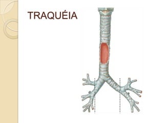 TRAQUÉIA
 