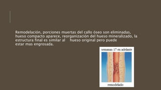 Remodelación, porciones muertas del callo óseo son eliminadas,
hueso compacto aparece, reorganización del hueso mineralizado, la
estructura final es similar al hueso original pero puede
estar mas engrosada.
 