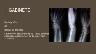 GABINETE
Radiografías:
AP
lateral de muñeca
Lateral con elevación de 15° (esto permite una
adecuada observación de la superficie
articular)
 