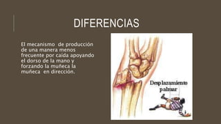 DIFERENCIAS
El mecanismo de producción
de una manera menos
frecuente por caída apoyando
el dorso de la mano y
forzando la muñeca la
muñeca en dirección.
 