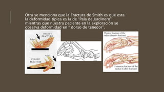 Otra se menciona que la Fractura de Smith es que esta
la deformidad típica es la de “Pala de Jardinero”
mientras que nuestra paciente en la exploración se
observa deformidad en “ dorso de tenedor”.
 