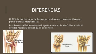 DIFERENCIAS
El 70% de las fracturas de Barton se producen en hombres jóvenes
por lo general motociclistas.
Esta fractura clínicamente se diagnostica como Fx de Colles y solo el
estudio radiográfico nos da el dx certero.
 
