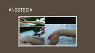 ANESTESIA
 