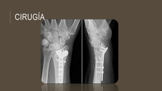 CIRUGÍA
 