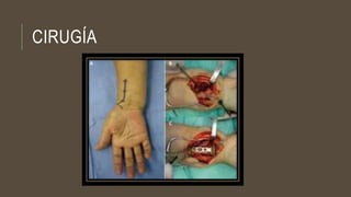 CIRUGÍA
 