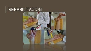 REHABILITACIÓN
 