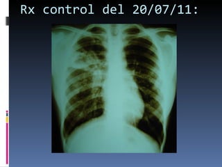Rx control del 20/07/11: 