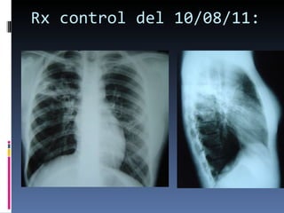 Rx control del 10/08/11: 