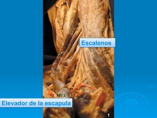 Escalenos




Elevador de la escapula
 