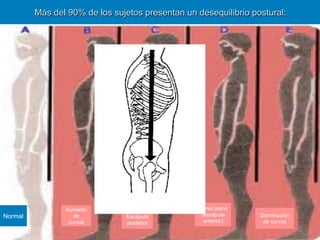 Más del 90% de los sujetos presentan un desequilibrio postural:




                Aumento                           Dorso plano
Normal             de          Escápula            (escápula     Disminución
                 curvas        posterior            anterior)     de curvas
 