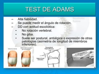 TEST DE ADAMS
 
