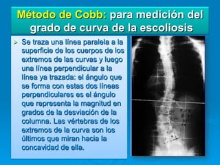 Método de Cobb: para medición del
   grado de curva de la escoliosis
Ø    Se traza una línea paralela a la
      superficie de los cuerpos de los
      extremos de las curvas y luego
      una línea perpendicular a la
      línea ya trazada: el ángulo que
      se forma con estas dos líneas
      perpendiculares es el ángulo
      que representa la magnitud en
      grados de la desviación de la
      columna. Las vértebras de los
      extremos de la curva son los
      últimos que miran hacia la
      concavidad de ella.
 